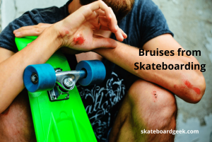 skateboarding is bad
