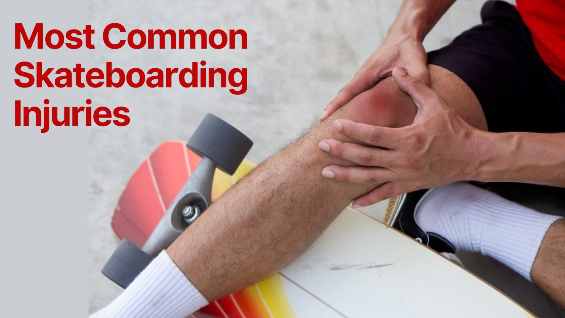 most common skateboard injuries