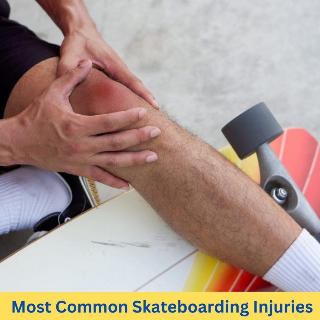 skateboard injuries per year